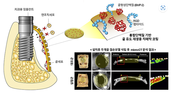 국내 공동연구팀, 홍합단백질로 임플란트용 차폐막 코팅 개발