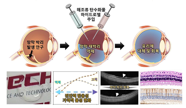 POSTECH, 실명 유발하는 망막 박리를 청색기술 활용해 끈적한 미역으로 치료한다